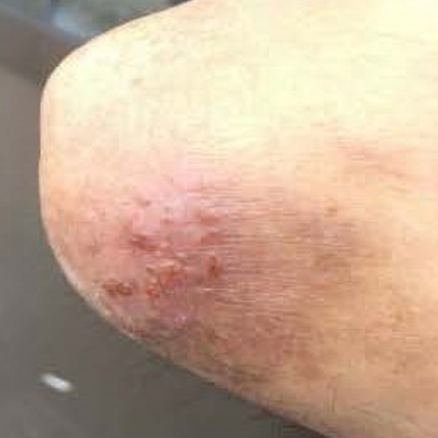 湯の花使用33日目