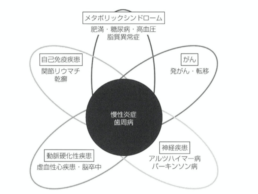 図9 歯周病と医科疾患の関連性:天野 敦雄。2022（参考文献5）の図1から引用。