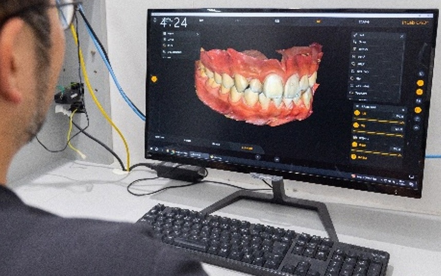 歯科技工士がCADを使用して補綴物を設計している様子です