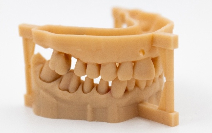 補綴物の精密な模型を作成するための最新の3Dプリンティング技術の様子です